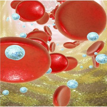 Nanocostrutto responsivo a ultrasuoni per teranostica antitumorale