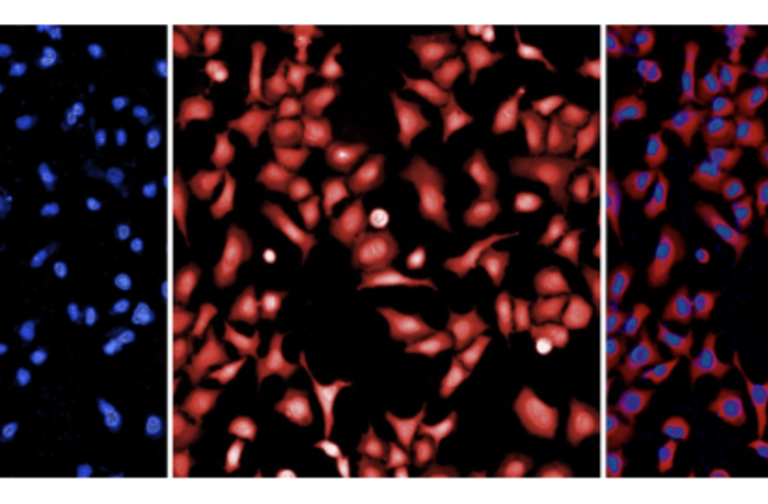 Quantificazione di biomarcatori molecolari e cellulari